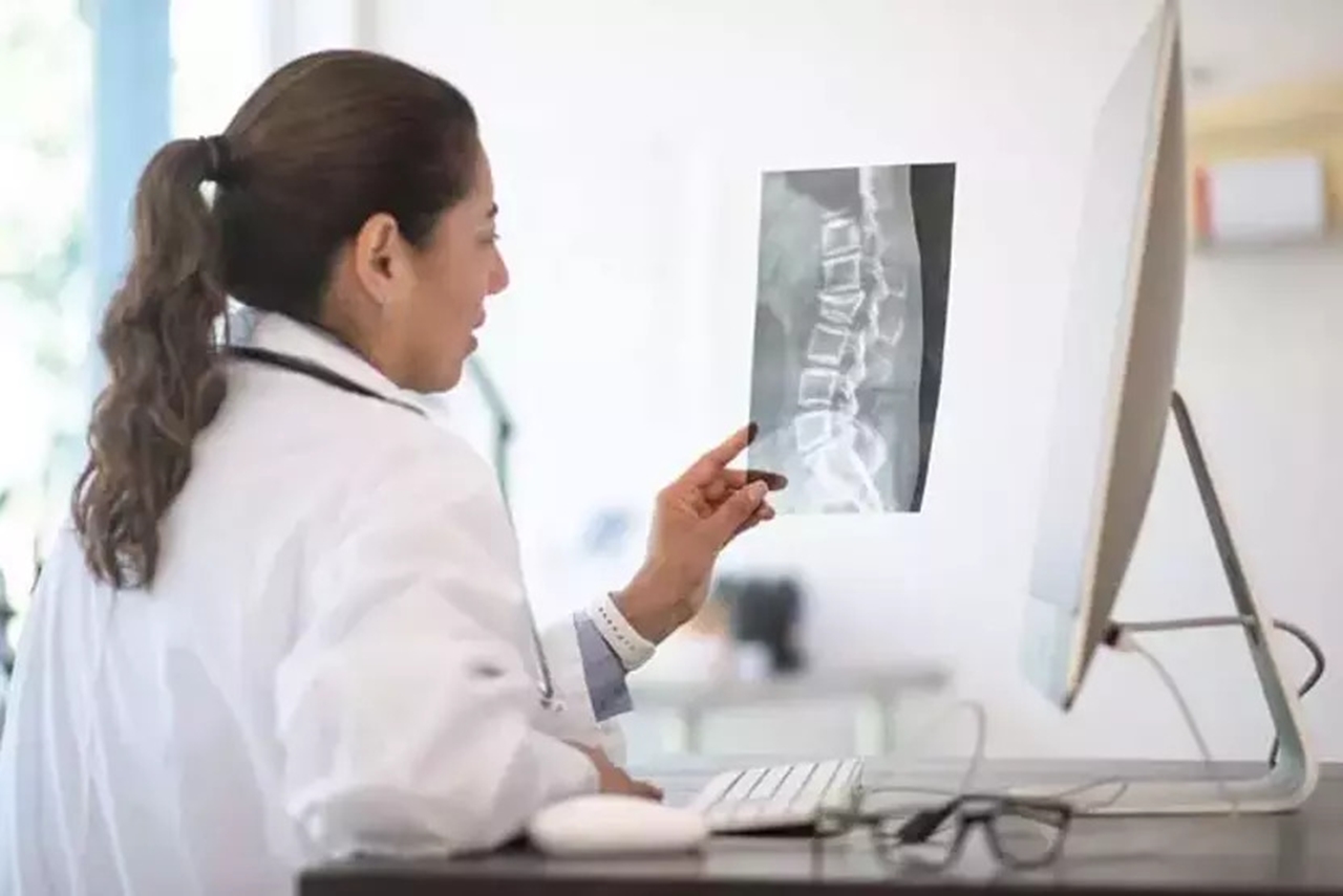 Kemiklerin sessiz çöküşü: Osteoporozun tehlikeli yüzü