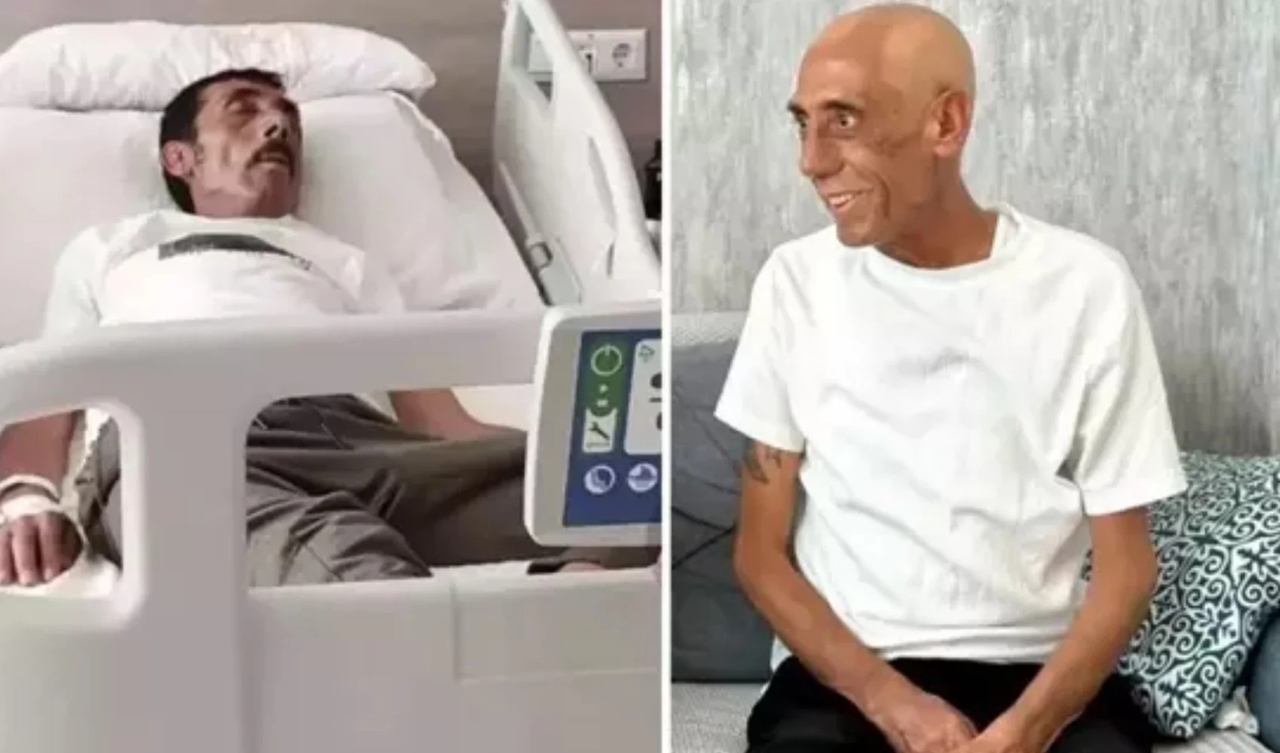 Ankaralı Turgut kanserle mücadeleyi kaybetti