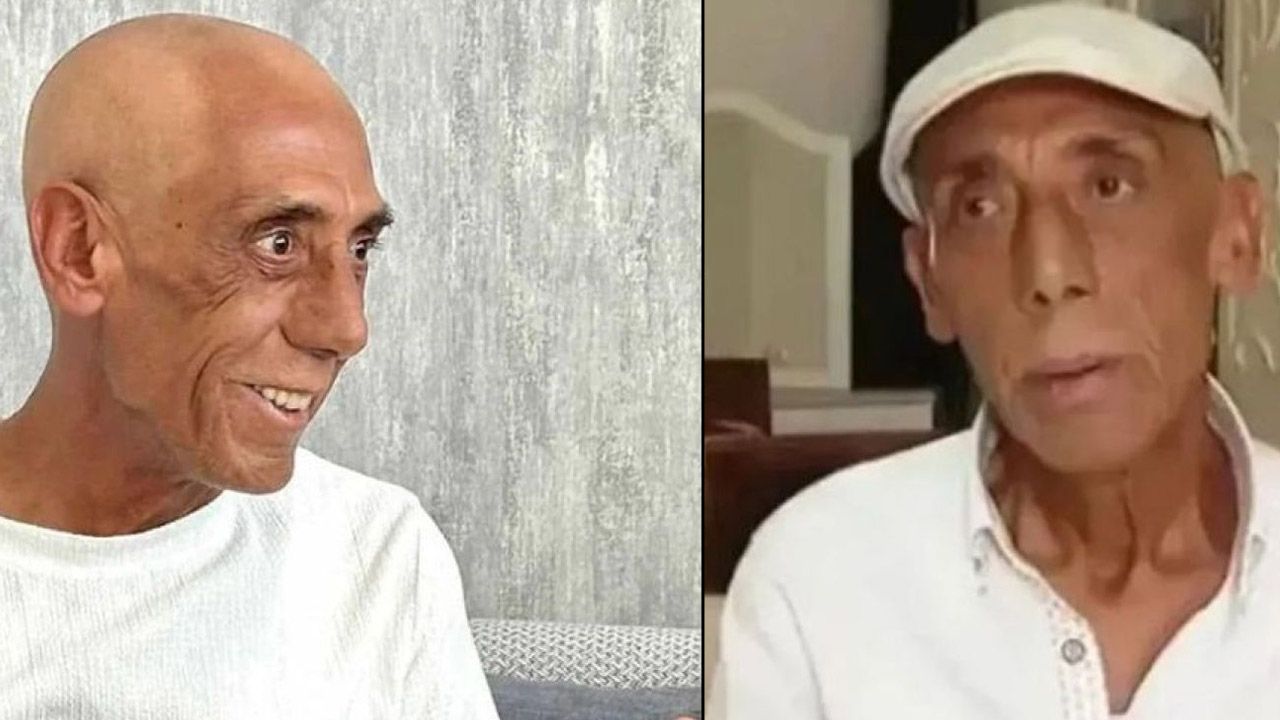 Ankaralı Turgut kanserle mücadeleyi kaybetti