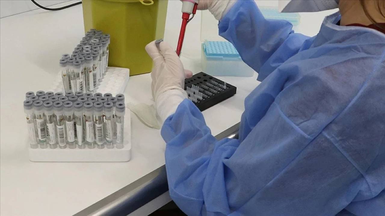 Salmonella nedir, Nasıl bulaşır ve belirtileri nelerdir?