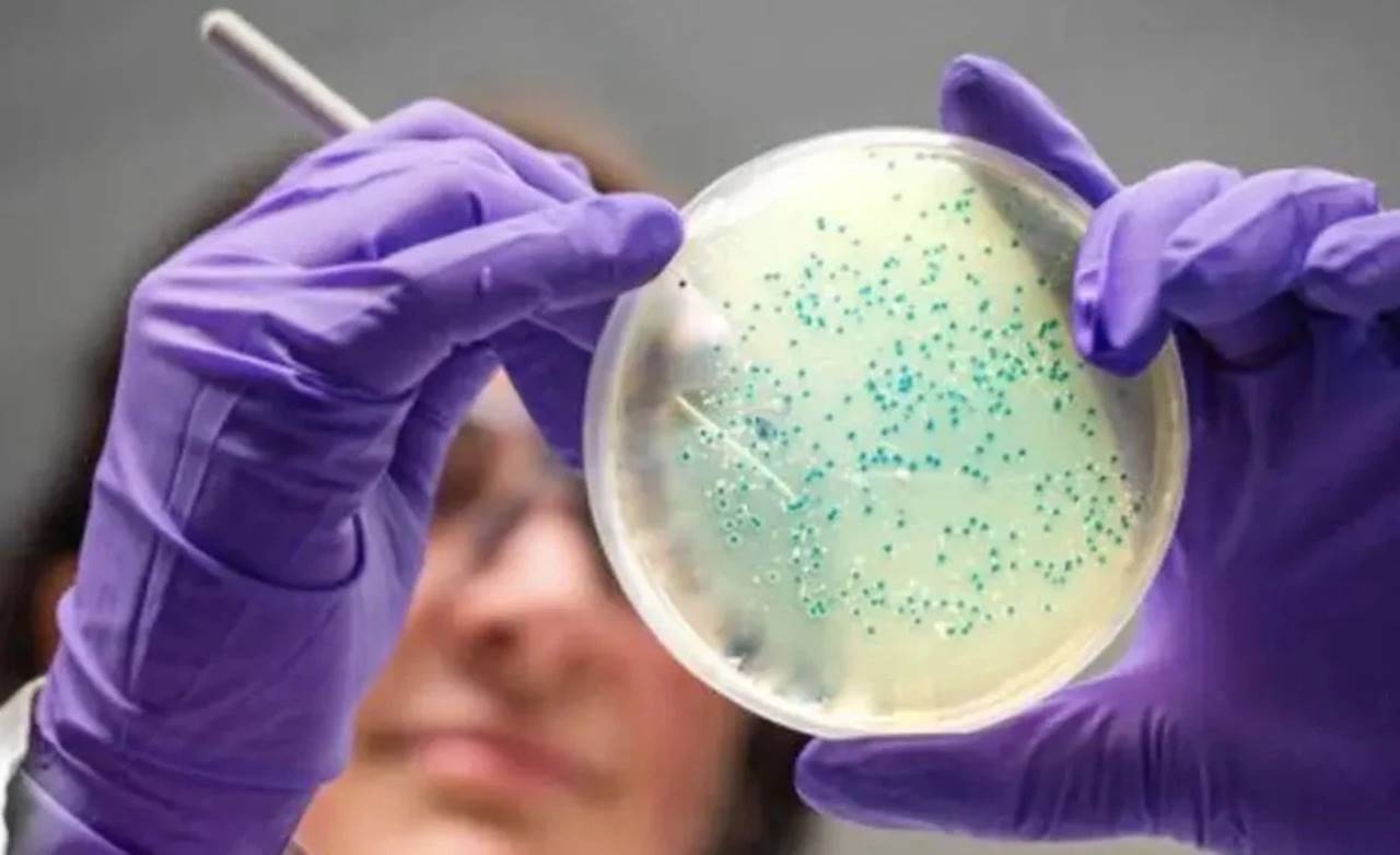 Salmonella nedir, Nasıl bulaşır ve belirtileri nelerdir?