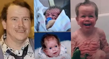 Tomm Tennent: Tıp dünyasını şaşkına çeviren olağanüstü bir vaka