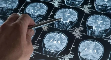 Demans Tehlikesi! Yaşlı Erkeklerde Genetik Etki Ortaya Çıktı