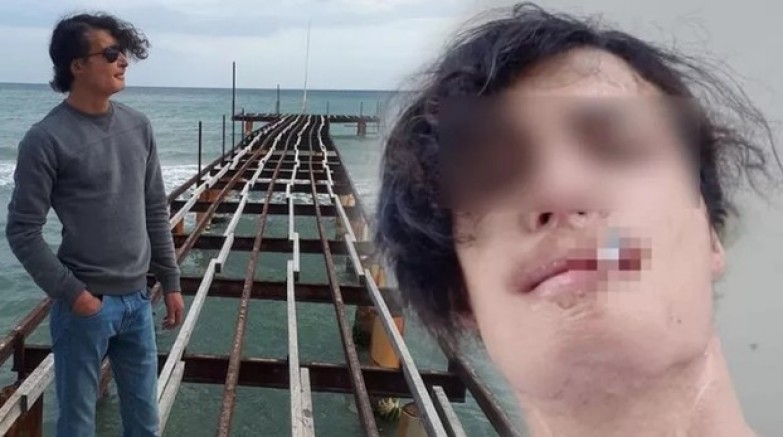 Akılalmaz olay! Ameliyata giren genç adam kabusa uyandı