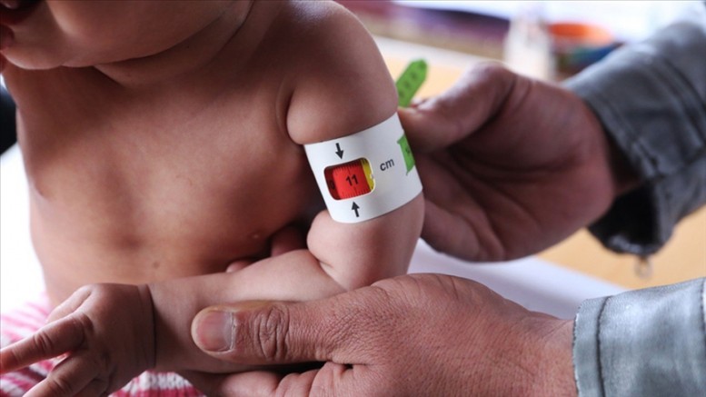 Save The Children: Bu yıl en az 17,6 milyon çocuk açlık içinde doğacak