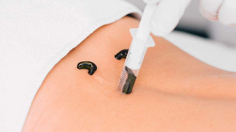 Ulubat'tan Dünyaya: Sülükler Neden Türklerin Eline Değmiyor